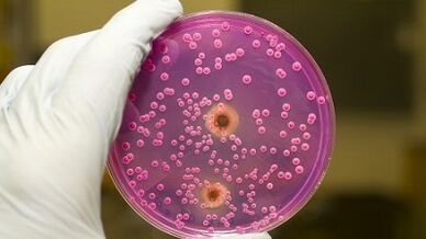 Shkarkimi patologjik tek burrat kur është i ngazëllyer